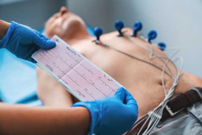 what-is-an-electrocardiogram-and-when-do-you-need-one